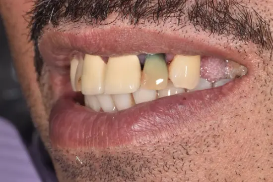 Restorative transformation before treatment