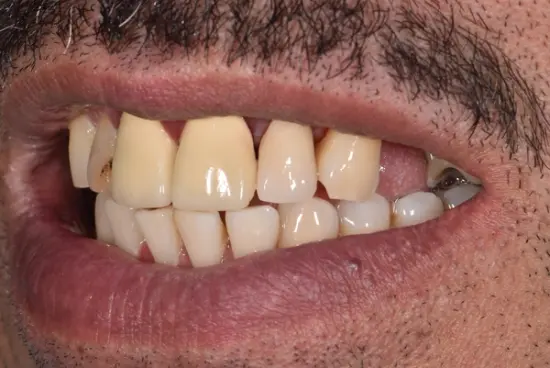 Restorative transformation after treatment