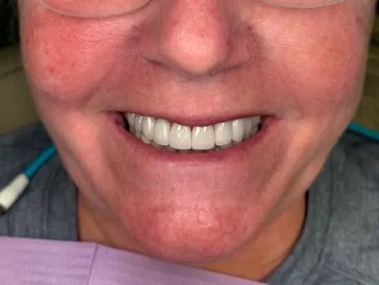Cosmetic transformation after treatment