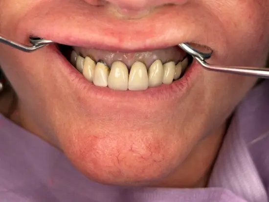 Cosmetic transformation before treatment